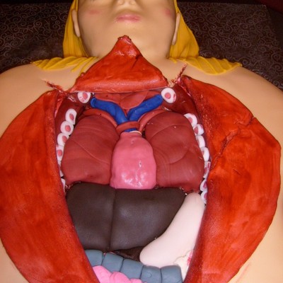 Abbie's Autopsy Cake Abbie's Autopsy Cake