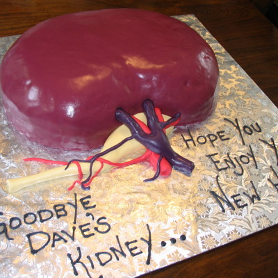 Dave's Kidney Dave's Kidney