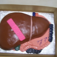 Kidney Person made a year wu=ith new transplant