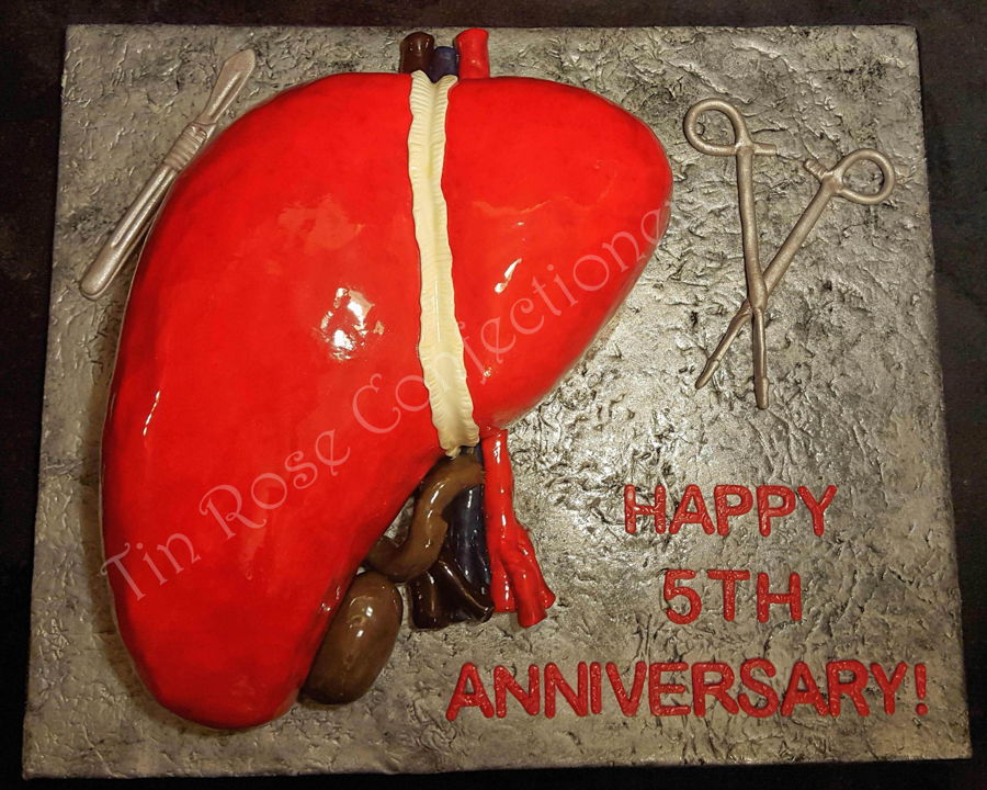 Liver Transplant Anniversary Cake